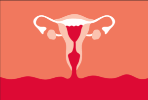 Dra Bianca Bocchi sangramento uterino, menstruação