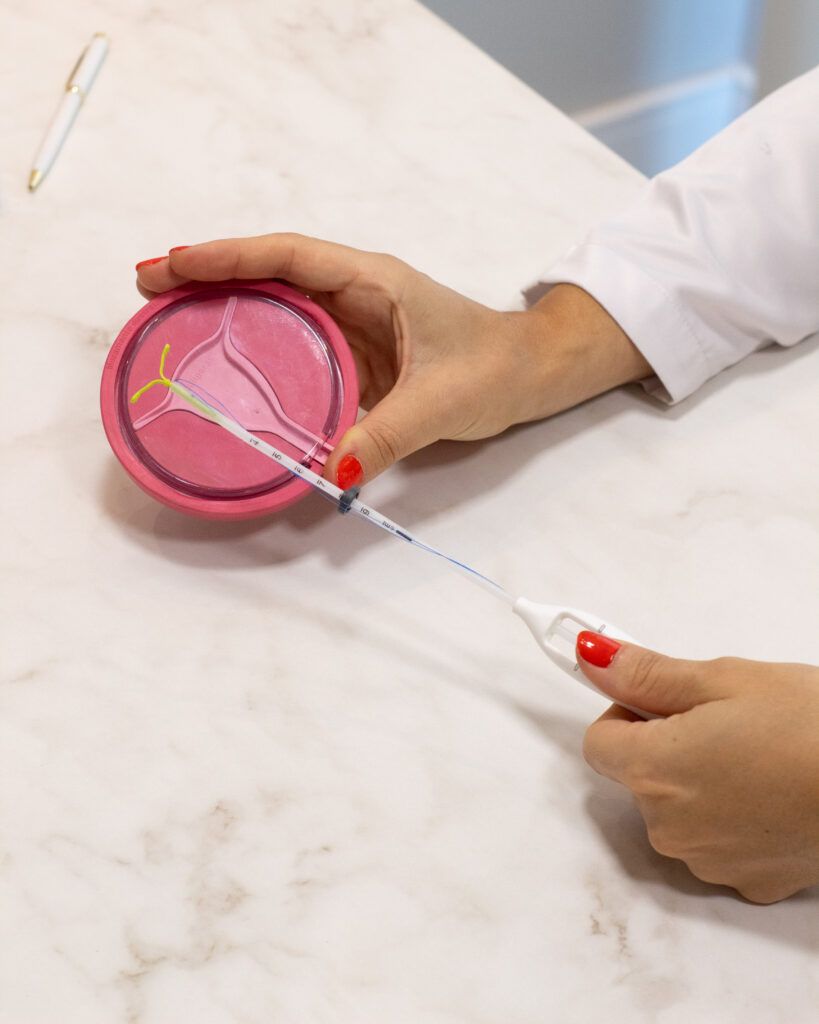 colocação de DIU - Dra Bianca Passaro Bocchi