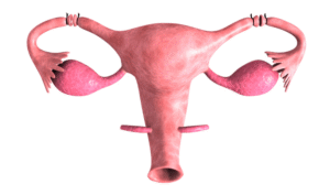 laqueadura tubas uterinas - Dra Bianca Bocchi